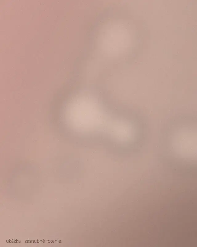 Zásnubný prsteň na ruke ženy, pár sa objíma v pozadí