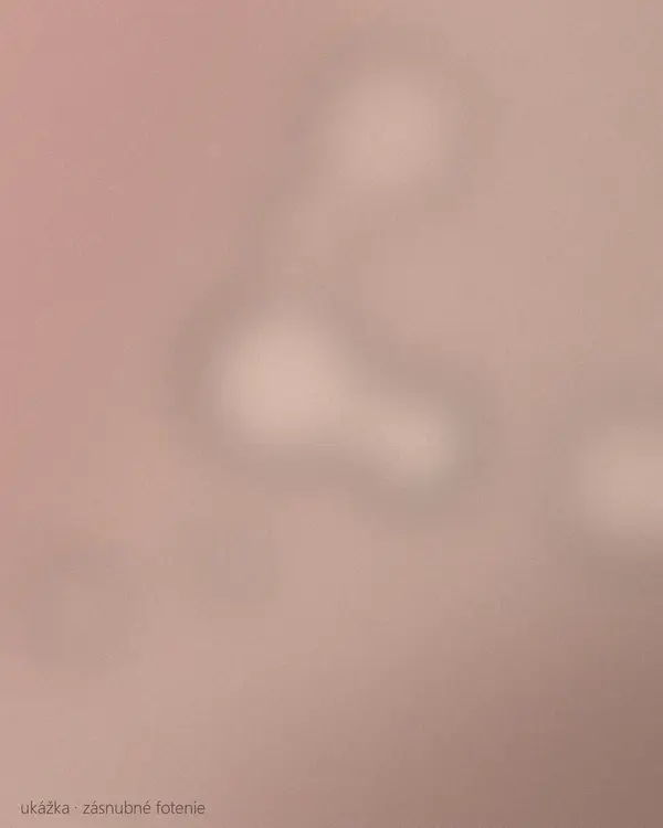 Zásnubný prsteň na ruke, pár sa objíma v pozadí